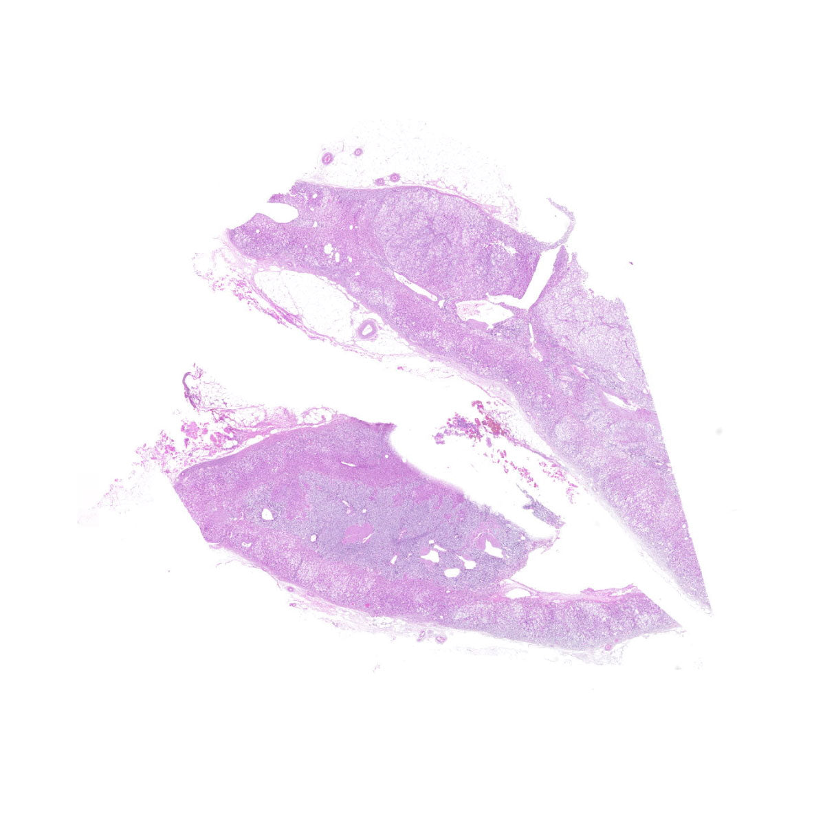 Human FFPE NAT Adrenal Tissue HuN-01-0006