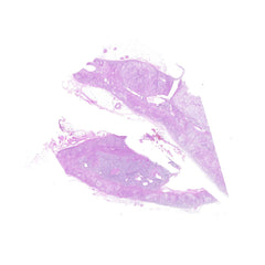 Human FFPE NAT Adrenal Tissue HuN-01-0006