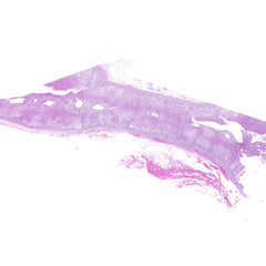 Human FFPE NAT Adrenal Tissue HuN-01-0009