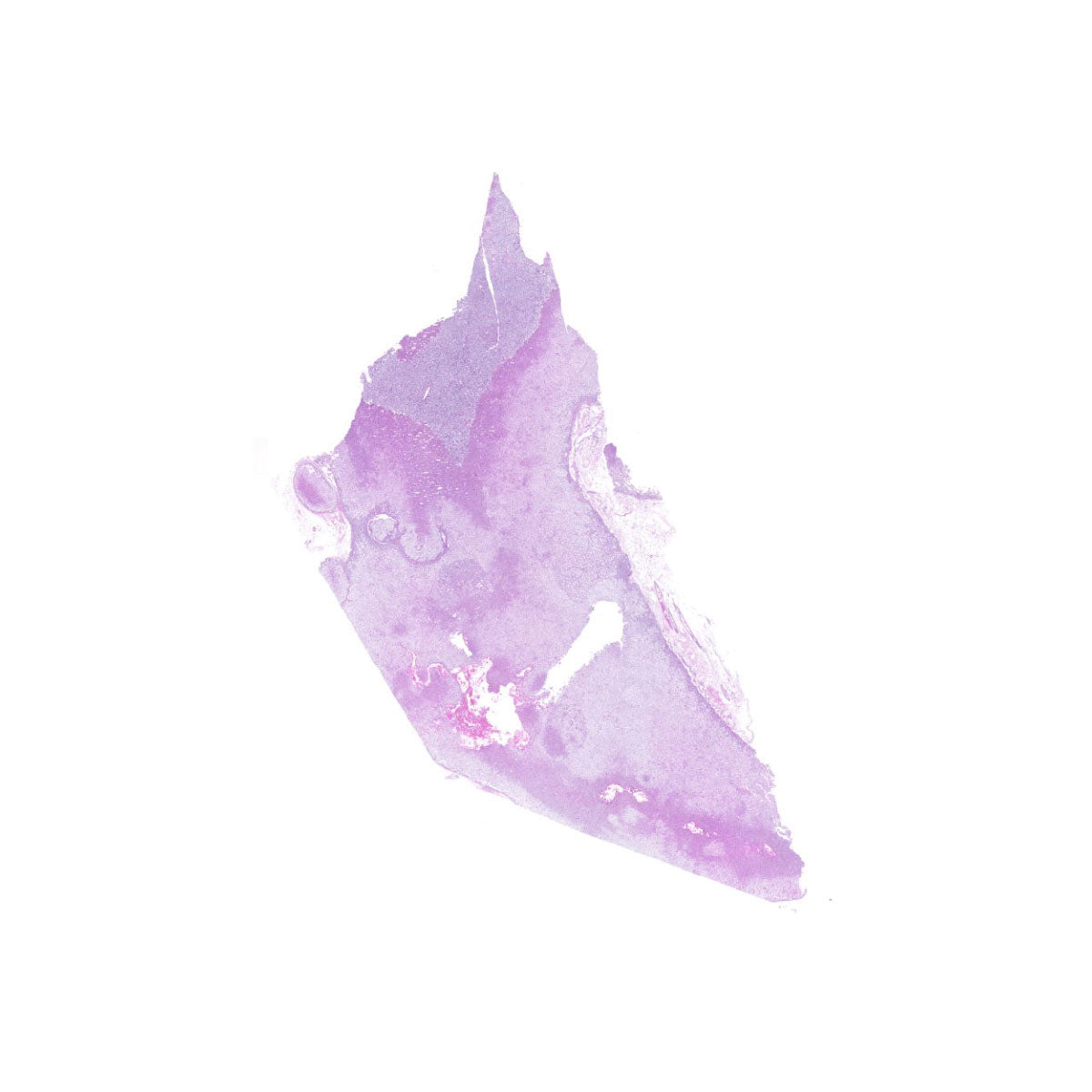 Human FFPE NAT Adrenal Tissue HuN-01-0010