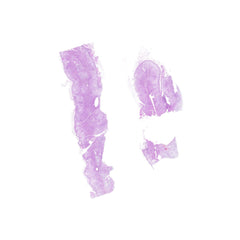 Human FFPE NAT Adrenal Tissue HuN-01-0011