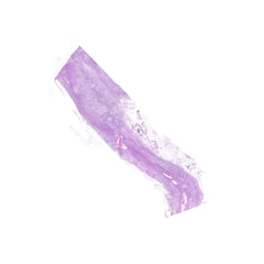 Human FFPE NAT Adrenal Tissue HuN-01-0014