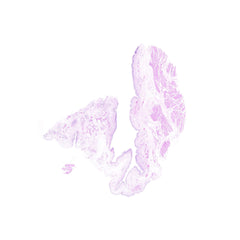 Human FFPE NAT Bladder Tissue HuN-03-0023