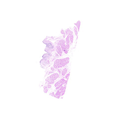 Human FFPE NAT Bladder Tissue HuN-03-0025