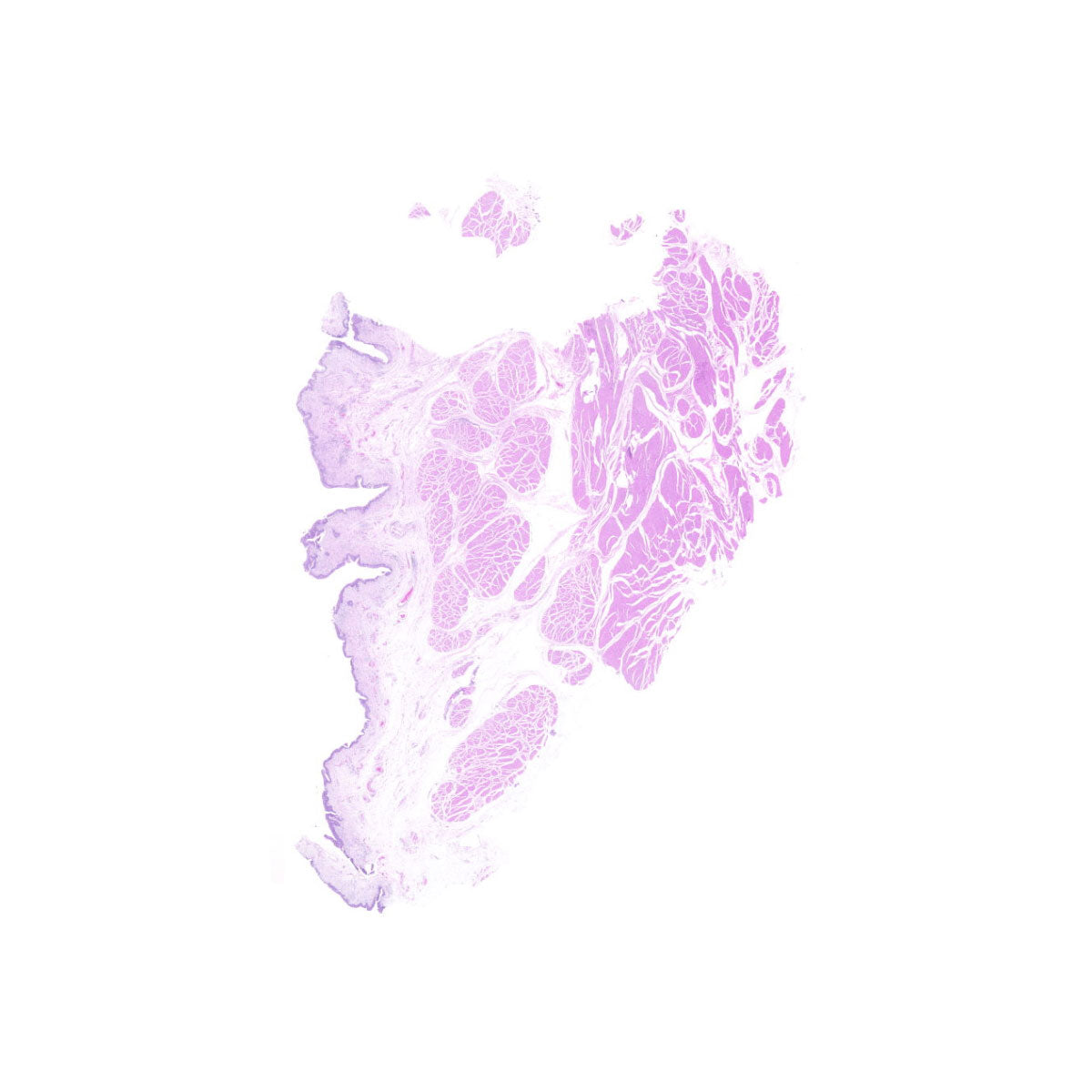 Human FFPE NAT Bladder Tissue HuN-03-0026