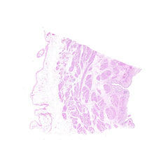 Human FFPE NAT Bladder Tissue HuN-03-0033A