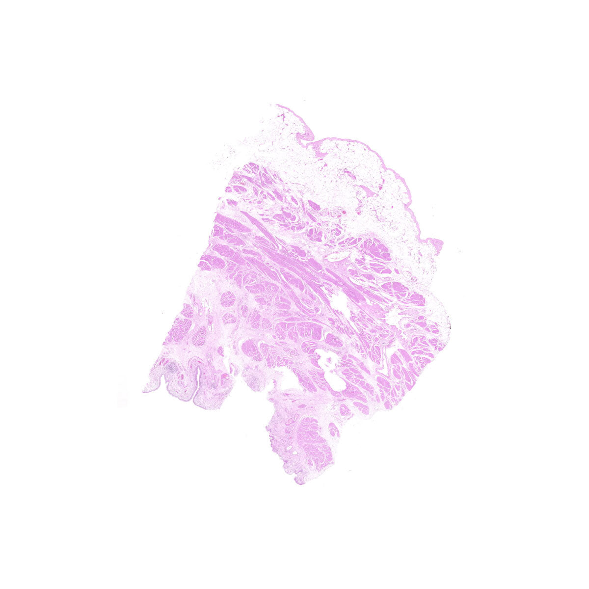 Human FFPE NAT Bladder Tissue HuN-03-0033B