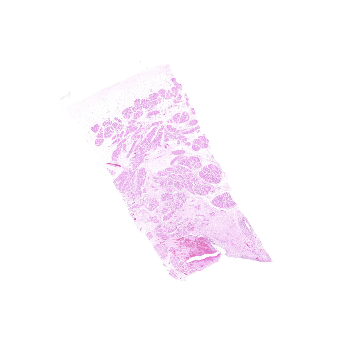 Human FFPE NAT Bladder Tissue HuN-03-0036A