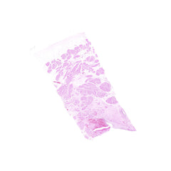 Human FFPE NAT Bladder Tissue HuN-03-0036A