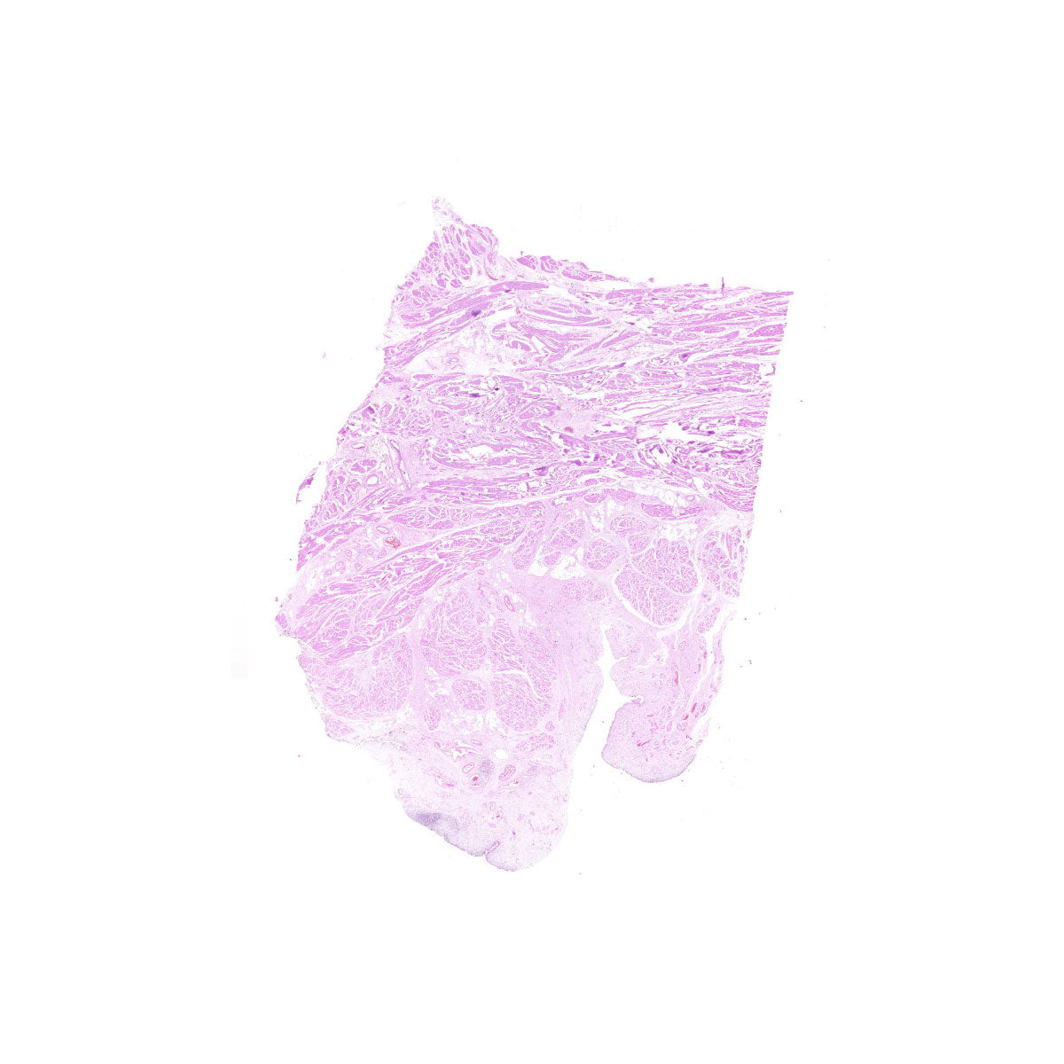 Human FFPE NAT Bladder Tissue HuN-03-0038A