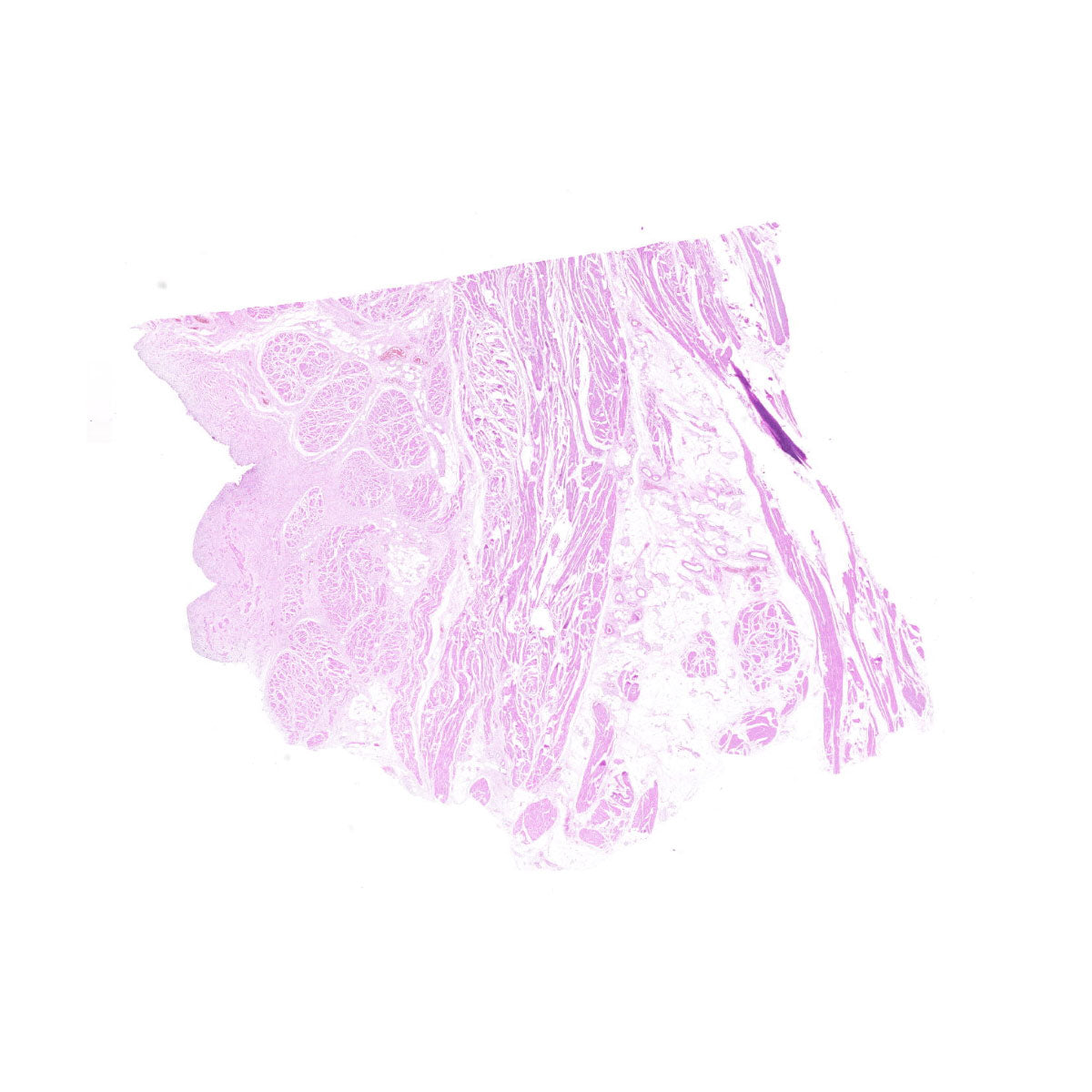 Human FFPE NAT Bladder Tissue HuN-03-0038B