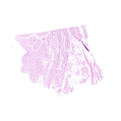 Human FFPE NAT Bladder Tissue HuN-03-0038B