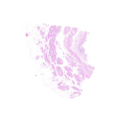 Human FFPE NAT Bladder Tissue HuN-03-0039A
