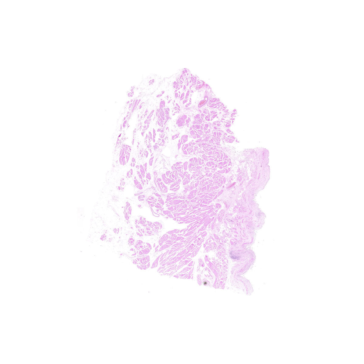 Human FFPE NAT Bladder Tissue HuN-03-0039B