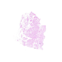 Human FFPE NAT Bladder Tissue HuN-03-0039B