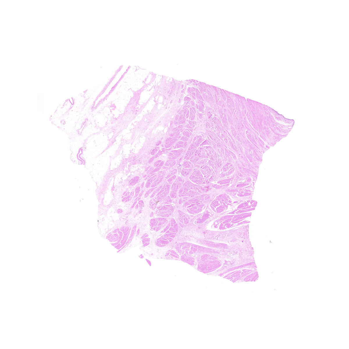 Human FFPE NAT Bladder Tissue HuN-03-0040A