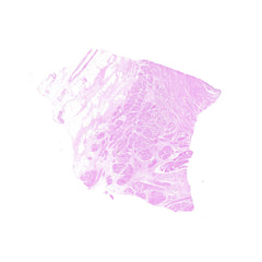 Human FFPE NAT Bladder Tissue HuN-03-0040A