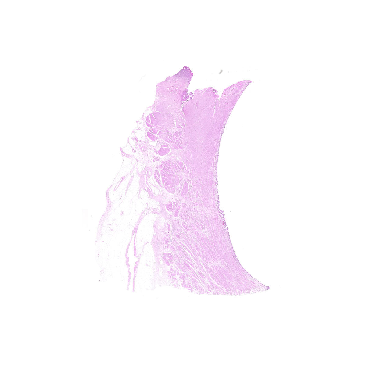 Human FFPE NAT Bladder Tissue HuN-03-0040B