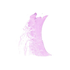 Human FFPE NAT Bladder Tissue HuN-03-0040B