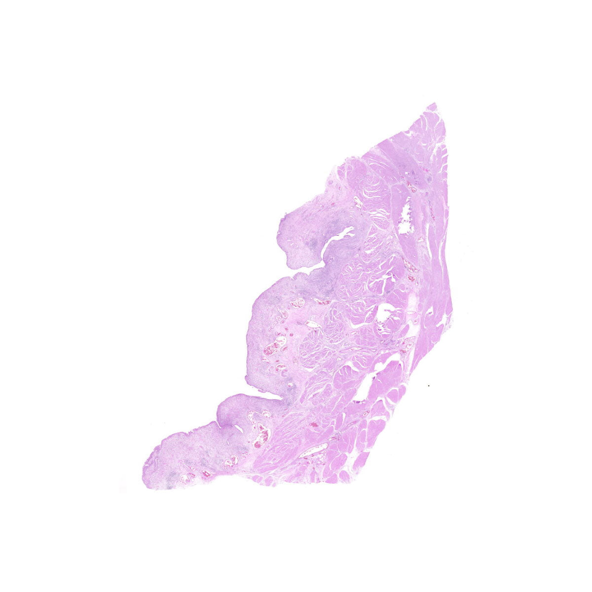 Human FFPE NAT Bladder Tissue HuN-03-0042