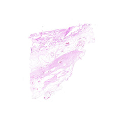 Human FFPE NAT Bladder Tissue HuN-03-0043B