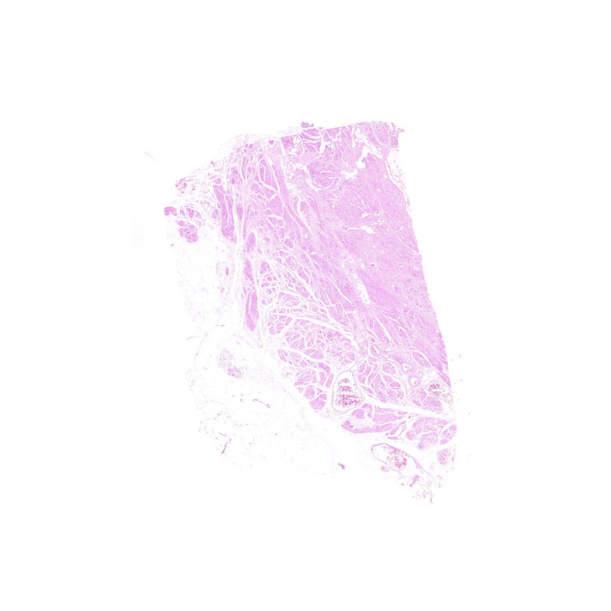 Human FFPE NAT Bladder Tissue HuN-03-0044A