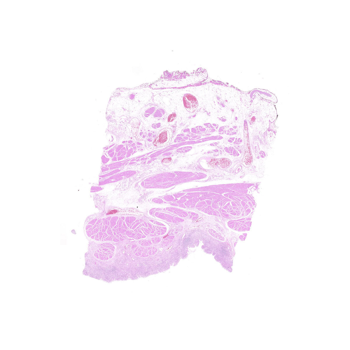 Human FFPE NAT Bladder Tissue HuN-03-0045A