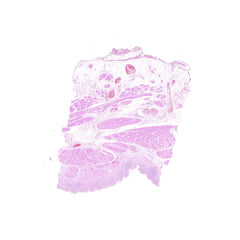 Human FFPE NAT Bladder Tissue HuN-03-0045A