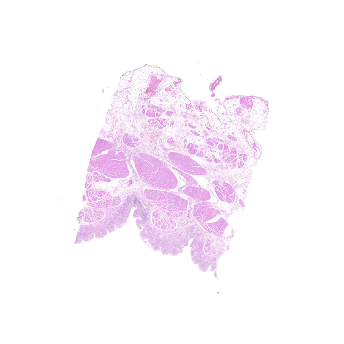 Human FFPE NAT Bladder Tissue HuN-03-0045B