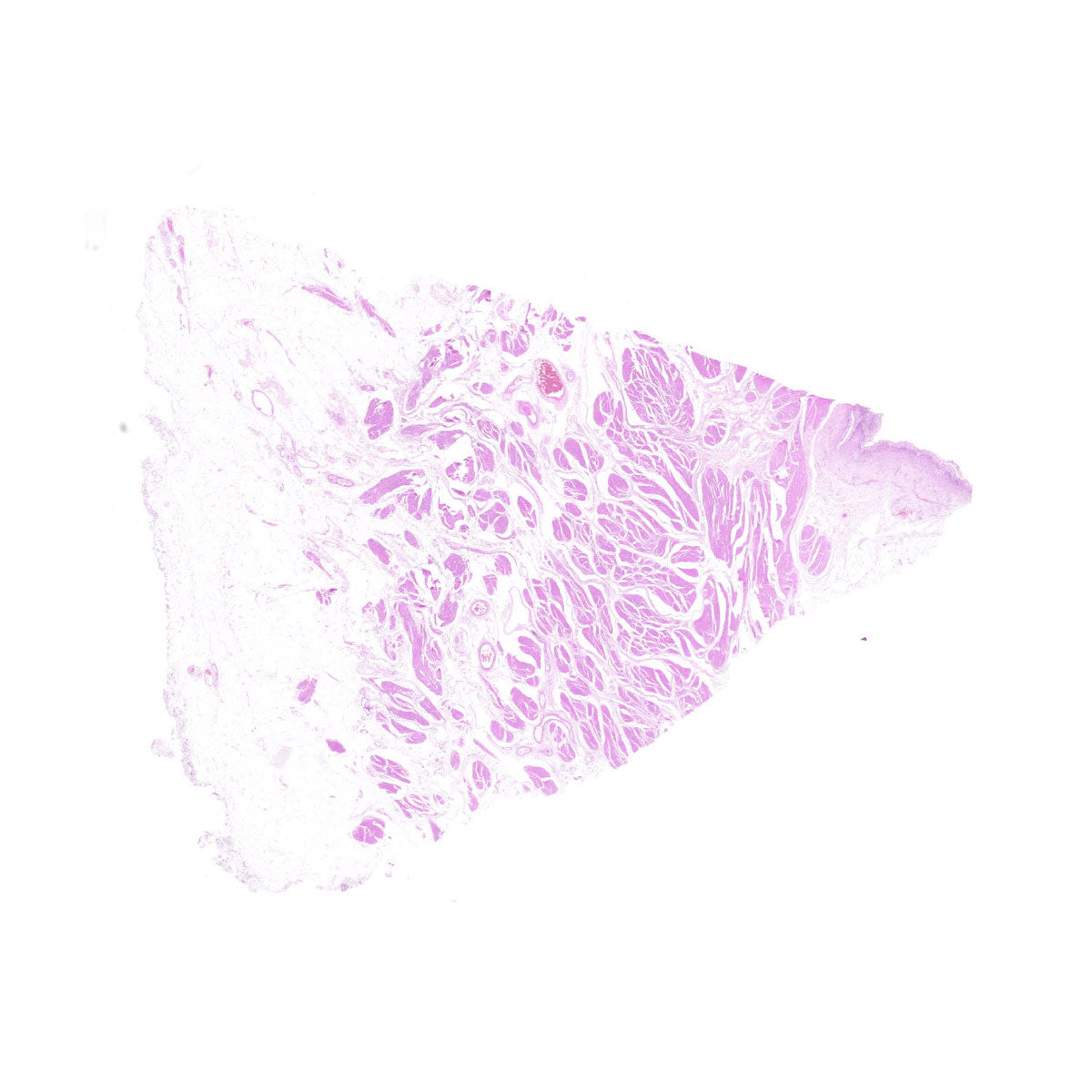 Human FFPE NAT Bladder Tissue HuN-03-0046B