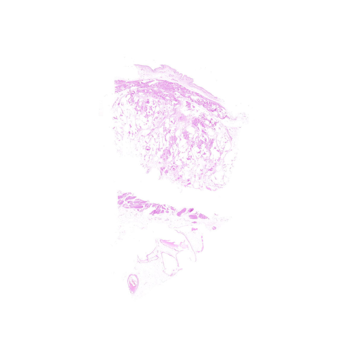 Human FFPE NAT Bladder Tissue HuN-03-0047
