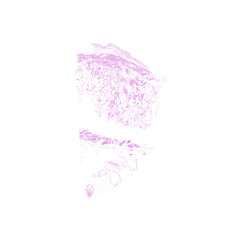 Human FFPE NAT Bladder Tissue HuN-03-0047