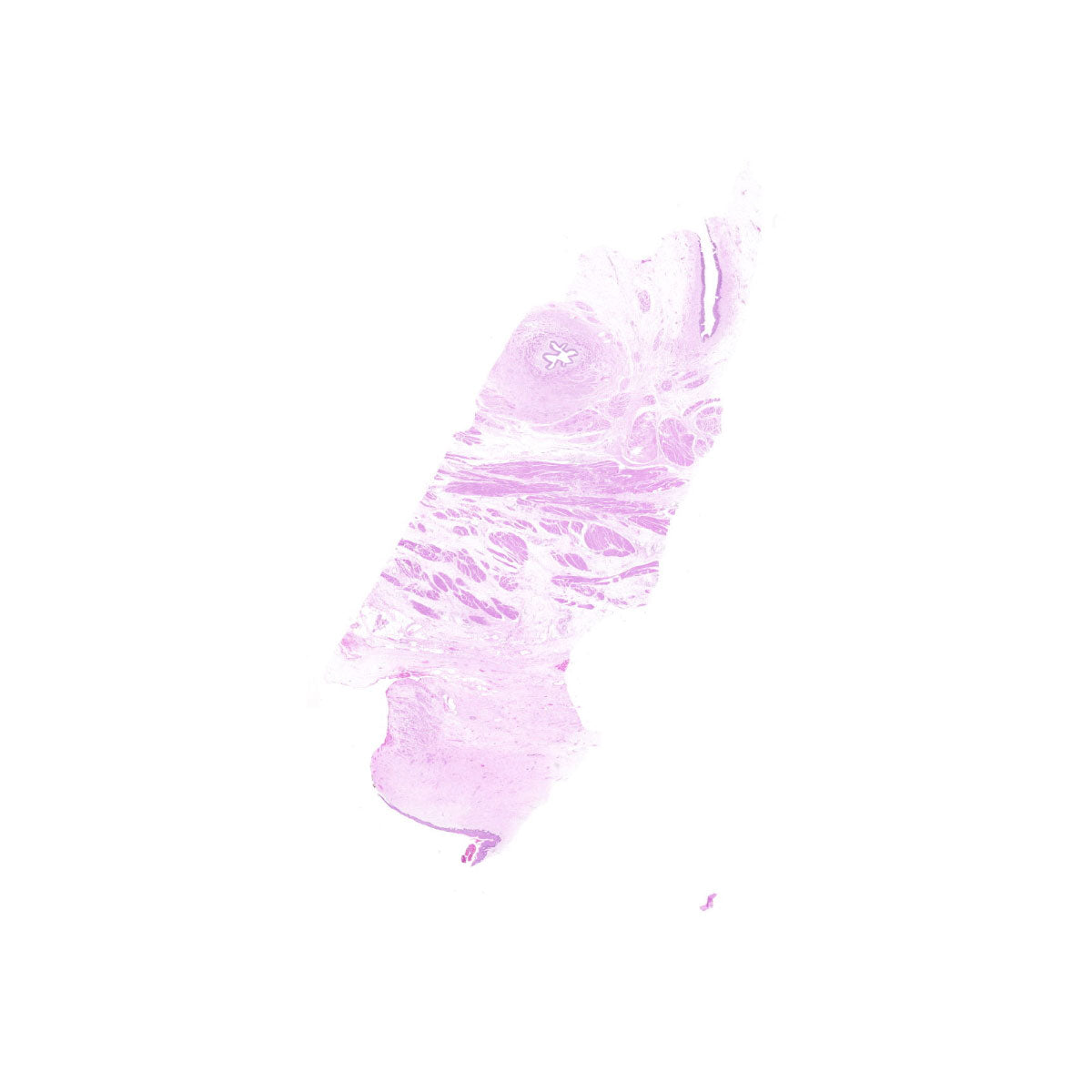 Human FFPE NAT Bladder Tissue HuN-03-0049A