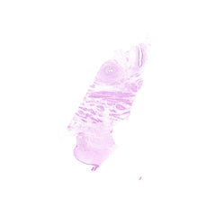 Human FFPE NAT Bladder Tissue HuN-03-0049A