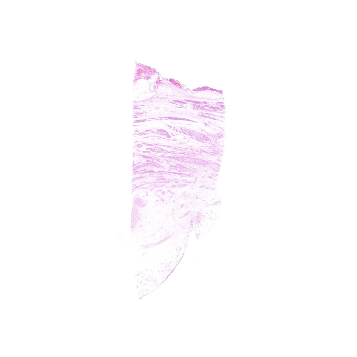 Human FFPE NAT Bladder Tissue HuN-03-0049B