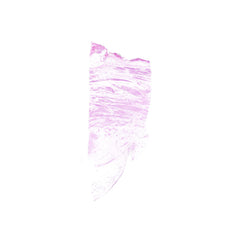 Human FFPE NAT Bladder Tissue HuN-03-0049B