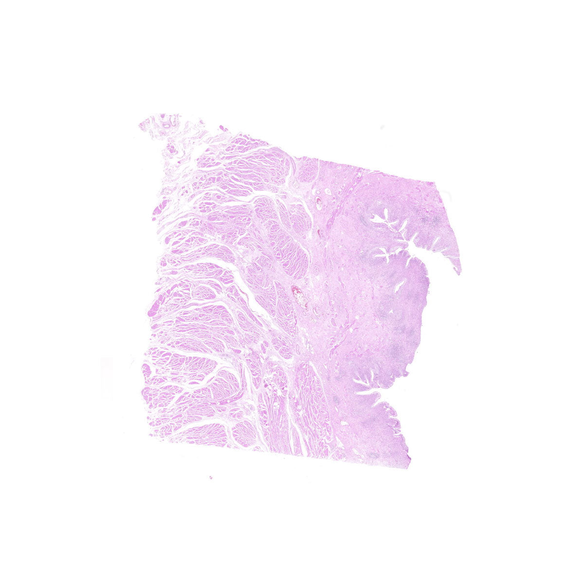 Human FFPE NAT Bladder Tissue HuN-03-0050A