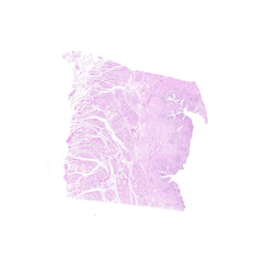 Human FFPE NAT Bladder Tissue HuN-03-0050A