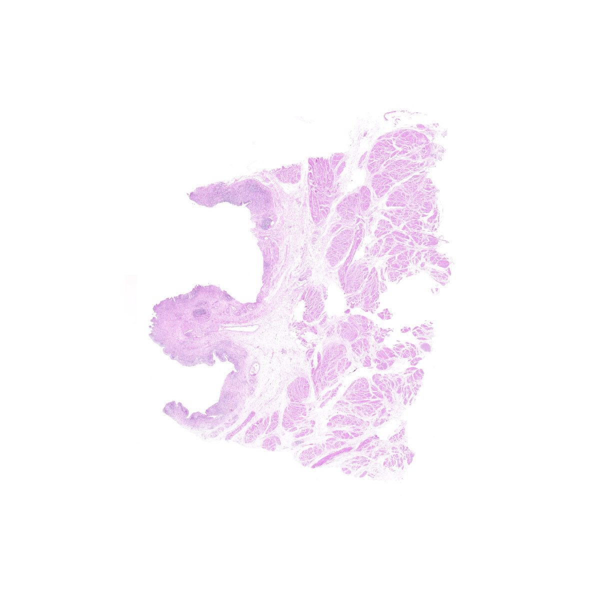 Human FFPE NAT Bladder Tissue HuN-03-0050B