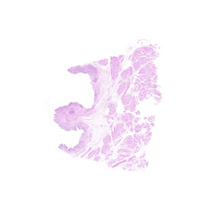 Human FFPE NAT Bladder Tissue HuN-03-0050B