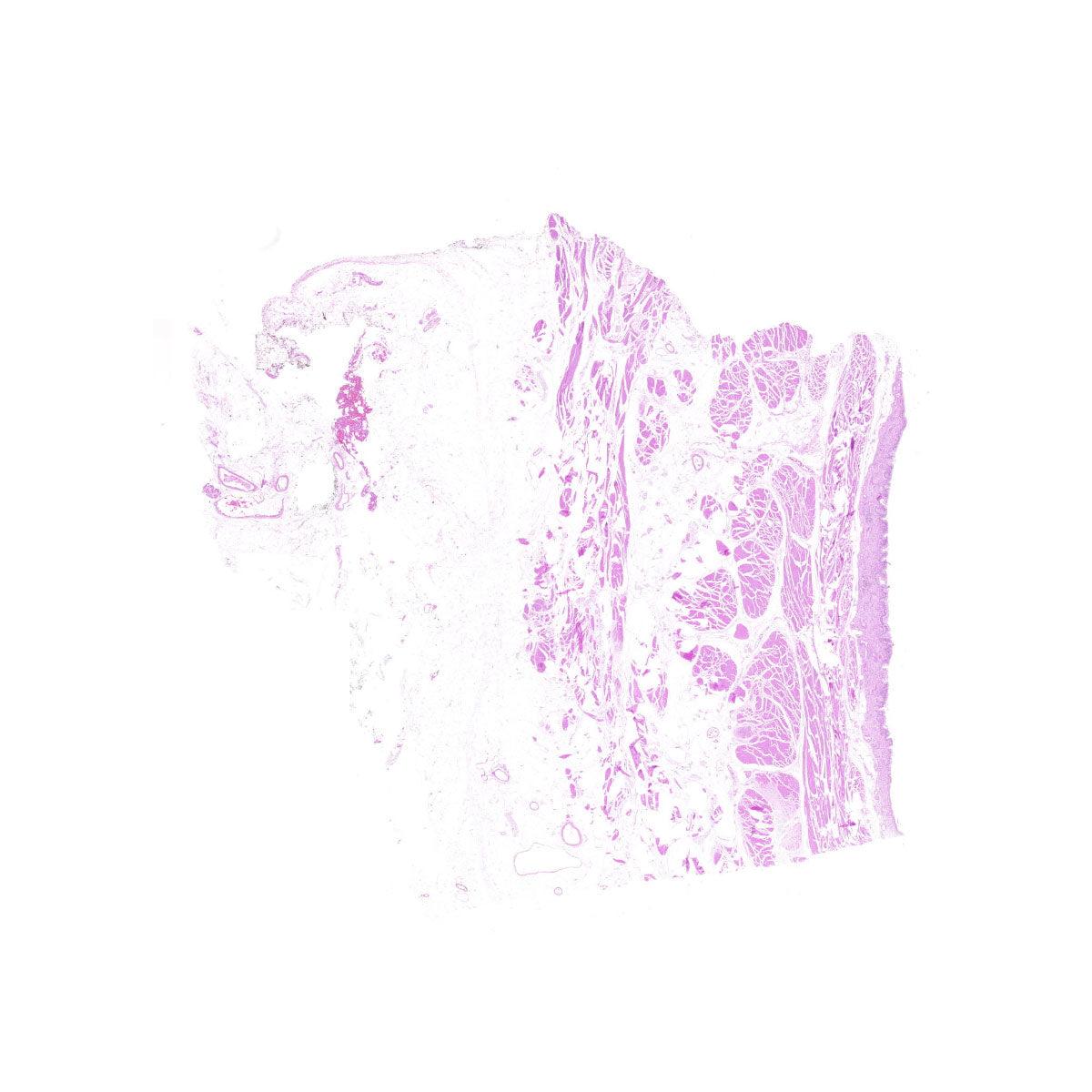 Human FFPE NAT Bladder Tissue HuN-03-0051A