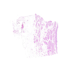 Human FFPE NAT Bladder Tissue HuN-03-0051A