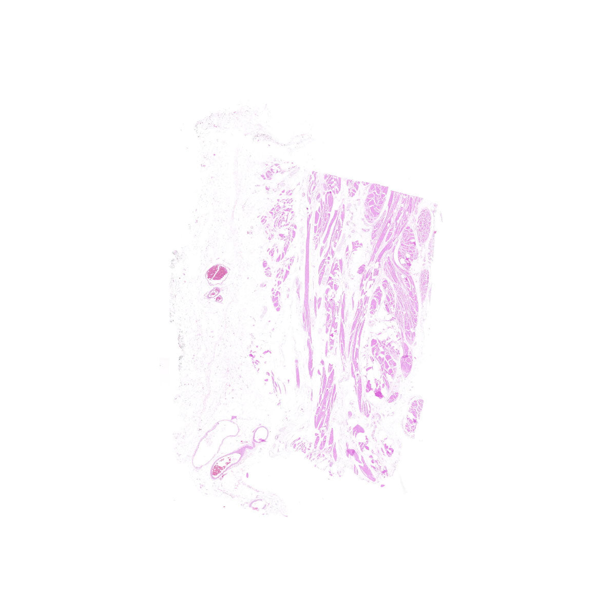 Human FFPE NAT Bladder Tissue HuN-03-0051B