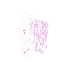 Human FFPE NAT Bladder Tissue HuN-03-0051B