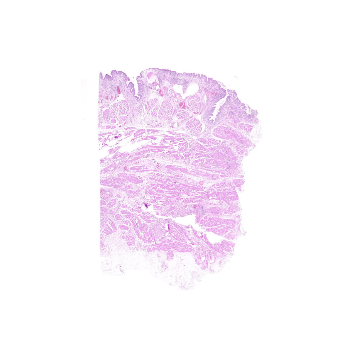 Human FFPE NAT Bladder Tissue HuN-03-0052A