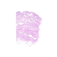 Human FFPE NAT Bladder Tissue HuN-03-0052A