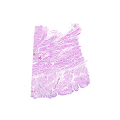 Human FFPE NAT Bladder Tissue HuN-03-0052B