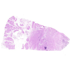 Human FFPE NAT Bladder Tissue HuN-03-0053