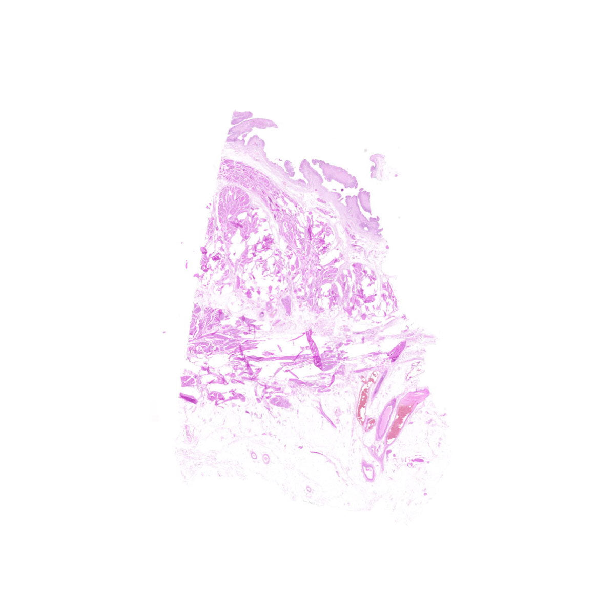 Human FFPE NAT Bladder Tissue HuN-03-0055A
