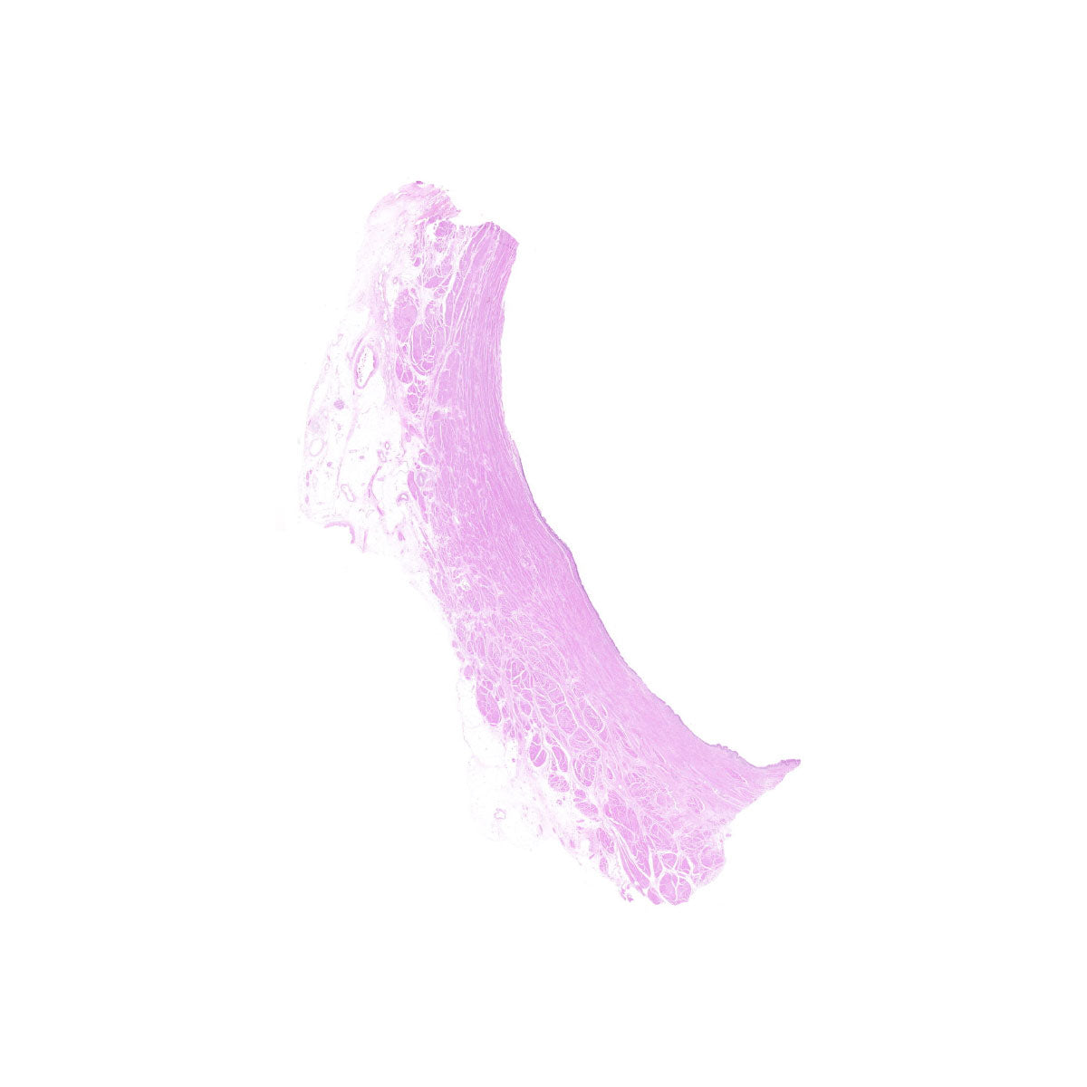 Human FFPE NAT Bladder Tissue HuN-03-0055B